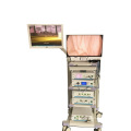 Medical Hospital Camera System Laparoscopic Complete Set Endoscopic Tower for Gallbladder Surgery